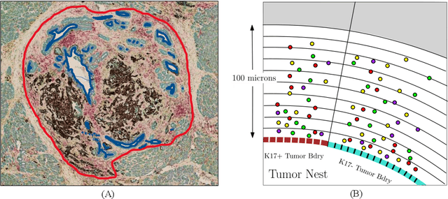 Figure 3 for A Novel Framework for Characterization of Tumor-Immune Spatial Relationships in Tumor Microenvironment
