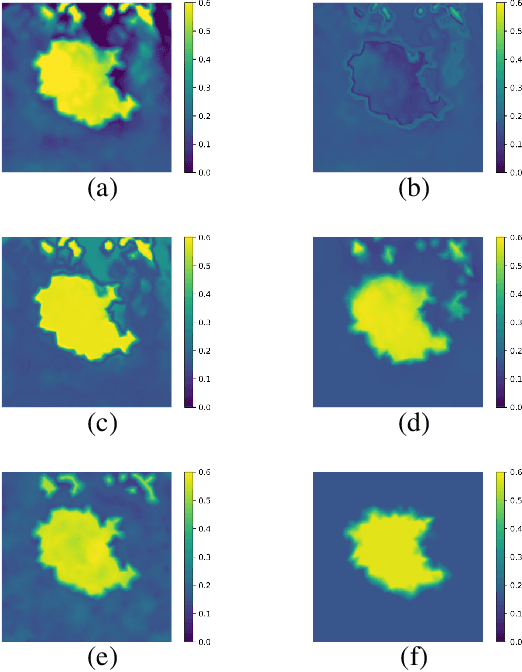 Figure 4 for Ultrasound Elasticity Imaging Using Physics-based Models And Learning-based Plug-And-Play Priors