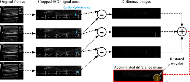 Figure 3 for Automating Carotid Intima-Media Thickness Video Interpretation with Convolutional Neural Networks