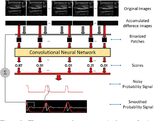 Figure 4 for Automating Carotid Intima-Media Thickness Video Interpretation with Convolutional Neural Networks
