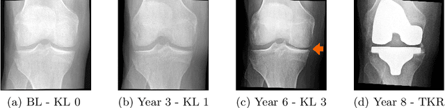 Figure 1 for DeepProg: A Transformer-based Framework for Predicting Disease Prognosis