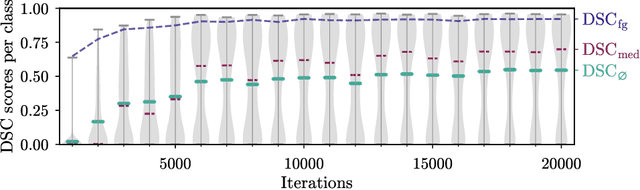 Figure 3 for 3D Segmentation Networks for Excessive Numbers of Classes: Distinct Bone Segmentation in Upper Bodies