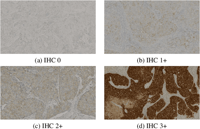 Figure 4 for BCI: Breast Cancer Immunohistochemical Image Generation through Pyramid Pix2pix