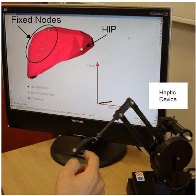 Figure 3 for Real-time visio-haptic interaction with static soft tissue model shaving geometric and material nonlinearity