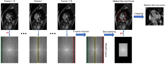 Figure 1 for Cine Cardiac MRI Motion Artifact Reduction Using a Recurrent Neural Network