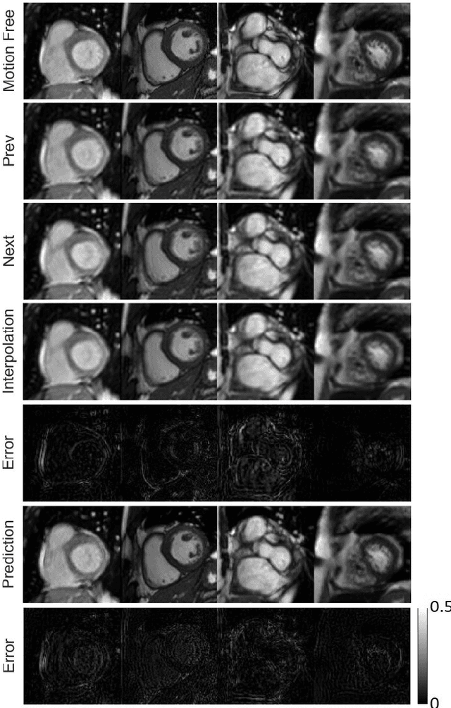 Figure 2 for Cine Cardiac MRI Motion Artifact Reduction Using a Recurrent Neural Network