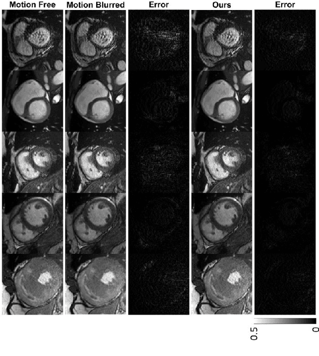 Figure 3 for Cine Cardiac MRI Motion Artifact Reduction Using a Recurrent Neural Network