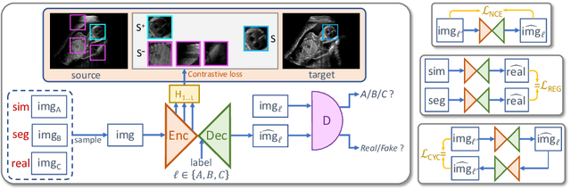 Figure 1 for Content-Preserving Unpaired Translation from Simulated to Realistic Ultrasound Images