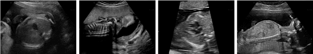 Figure 3 for Content-Preserving Unpaired Translation from Simulated to Realistic Ultrasound Images
