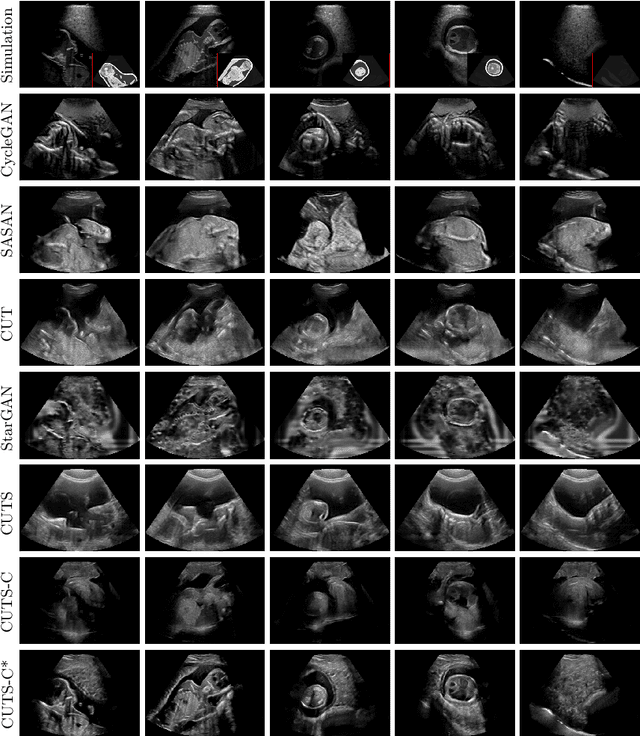 Figure 4 for Content-Preserving Unpaired Translation from Simulated to Realistic Ultrasound Images