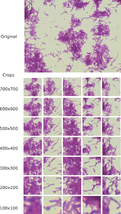 Figure 2 for Efficient Deep Learning Architectures for Fast Identification of Bacterial Strains in Resource-Constrained Devices