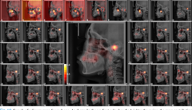 Figure 2 for Chronological age estimation of lateral cephalometric radiographs with deep learning
