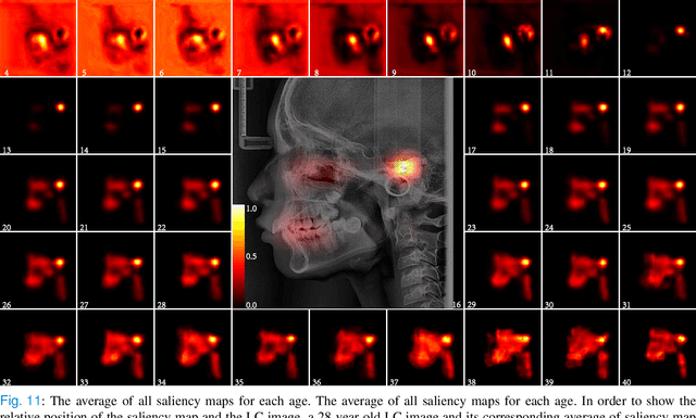 Figure 3 for Chronological age estimation of lateral cephalometric radiographs with deep learning