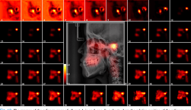 Figure 4 for Chronological age estimation of lateral cephalometric radiographs with deep learning