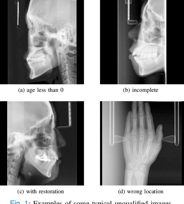 Figure 1 for Chronological age estimation of lateral cephalometric radiographs with deep learning