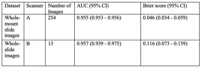 Figure 1 for Deep Learning for Prostate Pathology