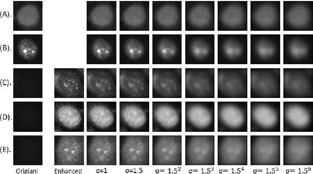 Figure 1 for HEp-2 Cell Classification: The Role of Gaussian Scale Space Theory as A Pre-processing Approach