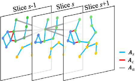 Figure 3 for Knee Cartilage Defect Assessment by Graph Representation and Surface Convolution