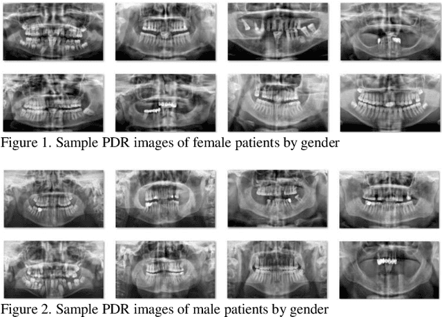 Figure 1 for Human Gender Prediction Based on Deep Transfer Learning from Panoramic Radiograph Images