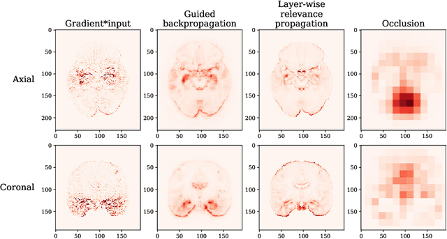 Figure 3 for Testing the robustness of attribution methods for convolutional neural networks in MRI-based Alzheimer's disease classification