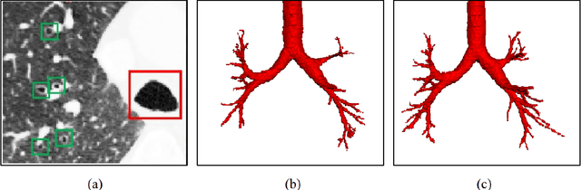 Figure 1 for Coarse-to-fine Airway Segmentation Using Multi information Fusion Network and CNN-based Region Growing