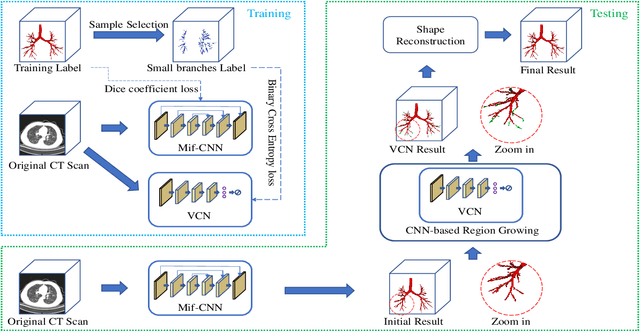 Figure 3 for Coarse-to-fine Airway Segmentation Using Multi information Fusion Network and CNN-based Region Growing