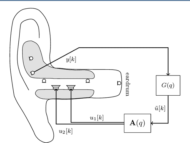 Figure 1 for Robust single- and multi-loudspeaker least-squares-based equalization for hearing devices