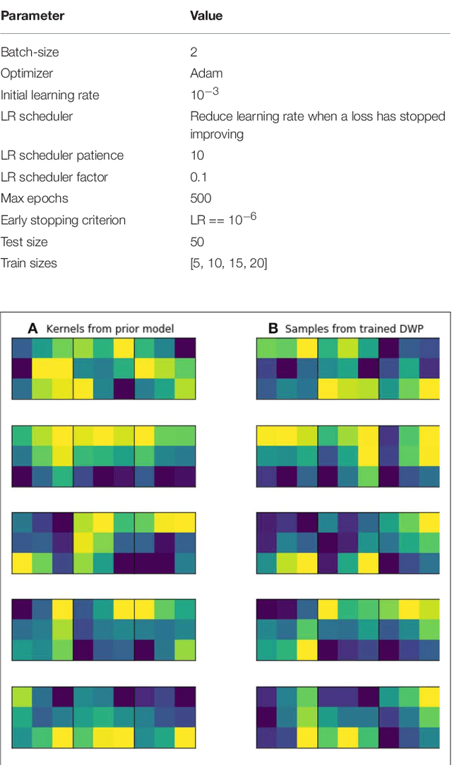 Figure 2 for Bayesian Generative Models for Knowledge Transfer in MRI Semantic Segmentation Problems