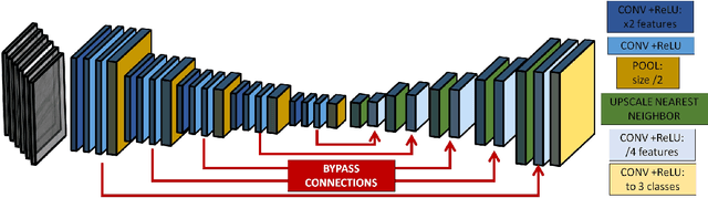 Figure 1 for Joint segmentation and classification of retinal arteries/veins from fundus images