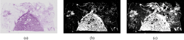 Figure 4 for A Semi-Supervised Framework for Automatic Pixel-Wise Breast Cancer Grading of Histological Images