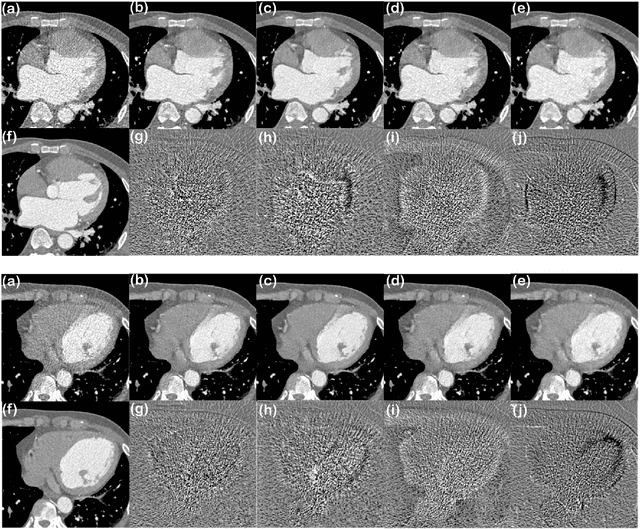 Figure 2 for AdaIN-Switchable CycleGAN for Efficient Unsupervised Low-Dose CT Denoising