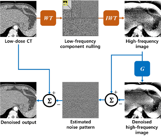 Figure 4 for AdaIN-Switchable CycleGAN for Efficient Unsupervised Low-Dose CT Denoising