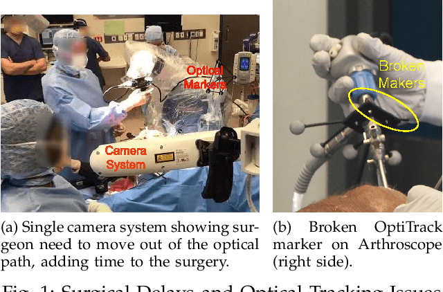 Figure 1 for Real-time Joint Motion Analysis and Instrument Tracking for Robot-Assisted Orthopaedic Surgery