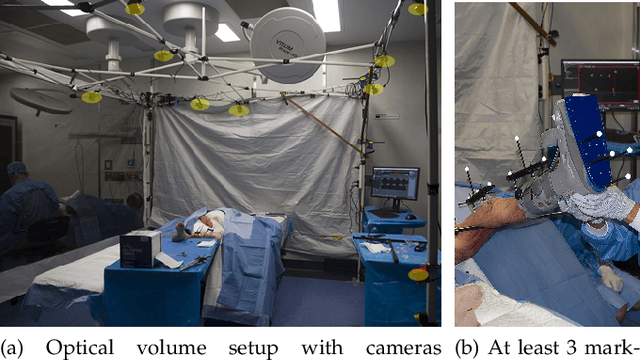 Figure 4 for Real-time Joint Motion Analysis and Instrument Tracking for Robot-Assisted Orthopaedic Surgery