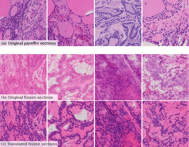 Figure 3 for Frozen-to-Paraffin: Categorization of Histological Frozen Sections by the Aid of Paraffin Sections and Generative Adversarial Networks