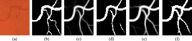 Figure 1 for Boosting Connectivity in Retinal Vessel Segmentation via a Recursive Semantics-Guided Network