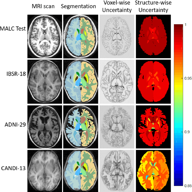 Figure 4 for Inherent Brain Segmentation Quality Control from Fully ConvNet Monte Carlo Sampling