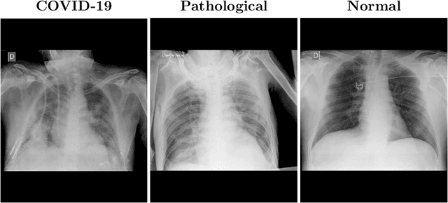 Figure 1 for Multi-stage transfer learning for lung segmentation using portable X-ray devices for patients with COVID-19