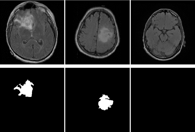 Figure 4 for Multi-stage transfer learning for lung segmentation using portable X-ray devices for patients with COVID-19