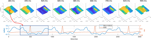 Figure 3 for Contactless Electrocardiogram Monitoring with Millimeter Wave Radar