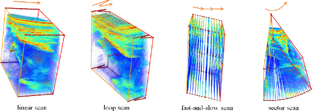 Figure 1 for Self Context and Shape Prior for Sensorless Freehand 3D Ultrasound Reconstruction