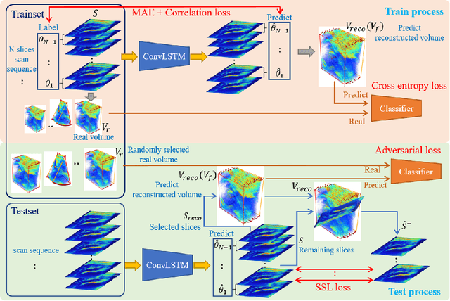 Figure 3 for Self Context and Shape Prior for Sensorless Freehand 3D Ultrasound Reconstruction