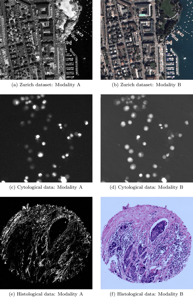 Figure 3 for Is Image-to-Image Translation the Panacea for Multimodal Image Registration? A Comparative Study