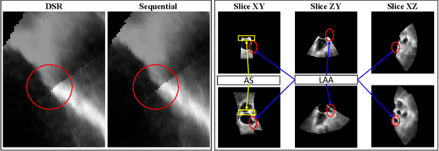 Figure 3 for Direct Simultaneous Multi-Image Registration