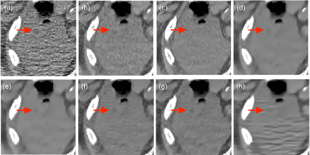 Figure 4 for CT Image Denoising with Perceptive Deep Neural Networks