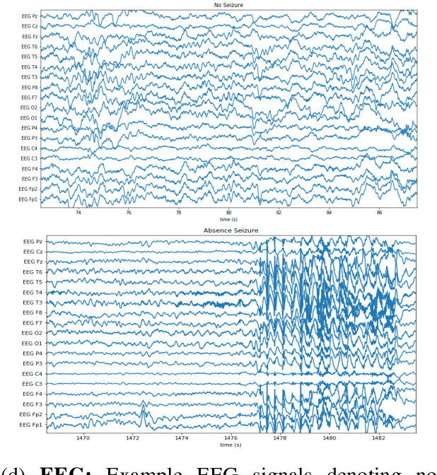 Figure 3 for Cross-Modal Data Programming Enables Rapid Medical Machine Learning