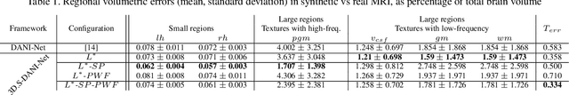 Figure 1 for Degenerative Adversarial NeuroImage Nets for 3D Simulations: Application in Longitudinal MRI