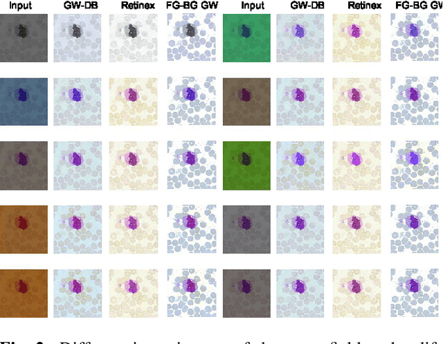 Figure 2 for Adaptive Gray World-Based Color Normalization of Thin Blood Film Images