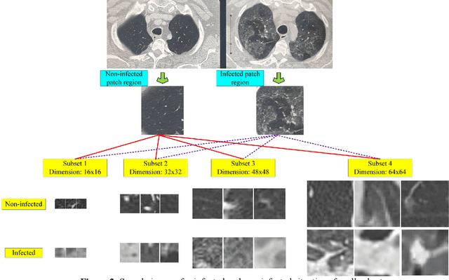 Figure 3 for Coronavirus (COVID-19) Classification using CT Images by Machine Learning Methods