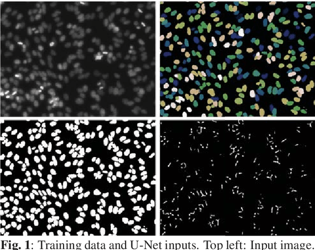 Figure 1 for Mask-RCNN and U-net Ensembled for Nuclei Segmentation